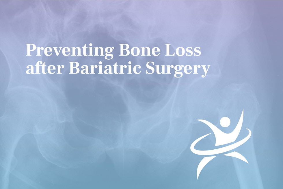 Preventing Bone Loss after Bariatric Surgery