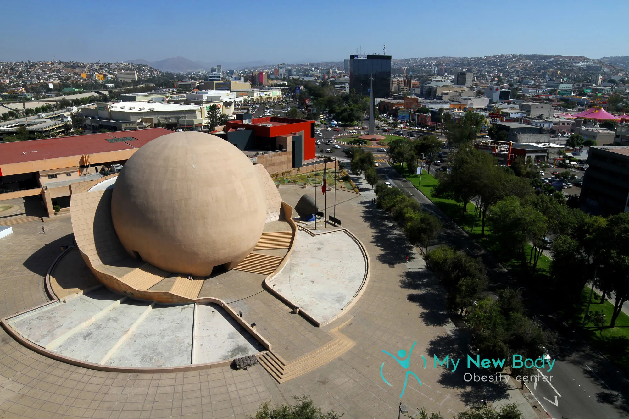 Top 7 reasons why Tijuana is the Best Place for Weight Loss Surgery