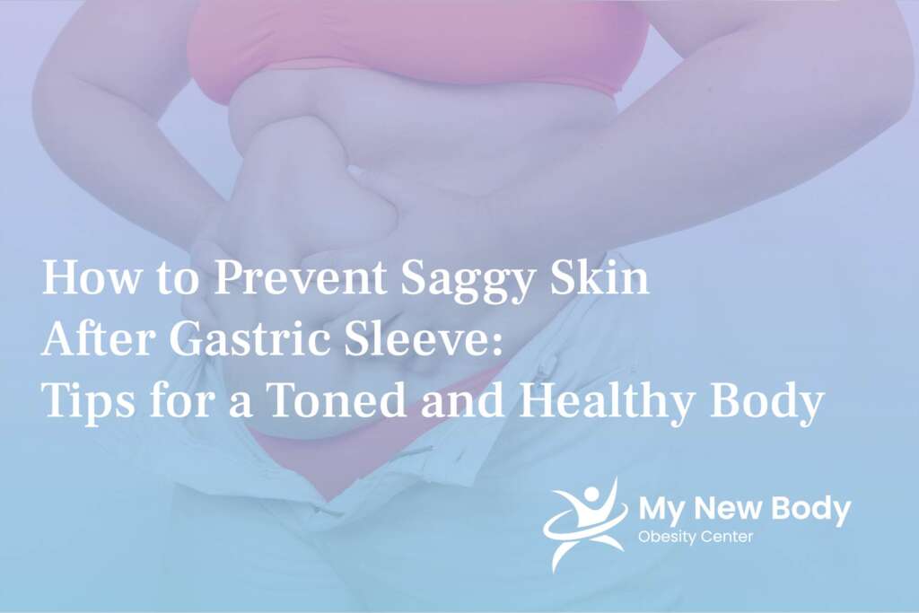 How to prevent saggy skin after gastric sleeve