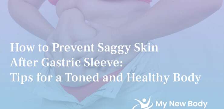 How to prevent saggy skin after gastric sleeve