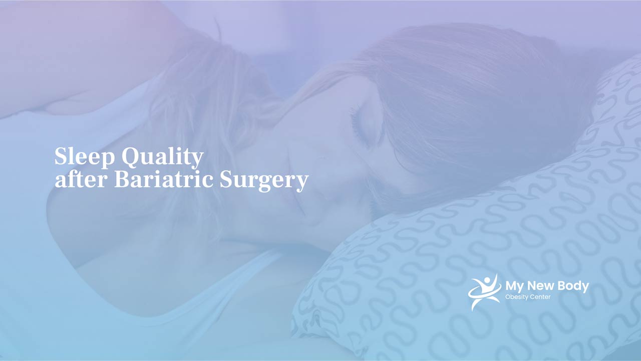 Sleep Quality after Bariatric Surgery