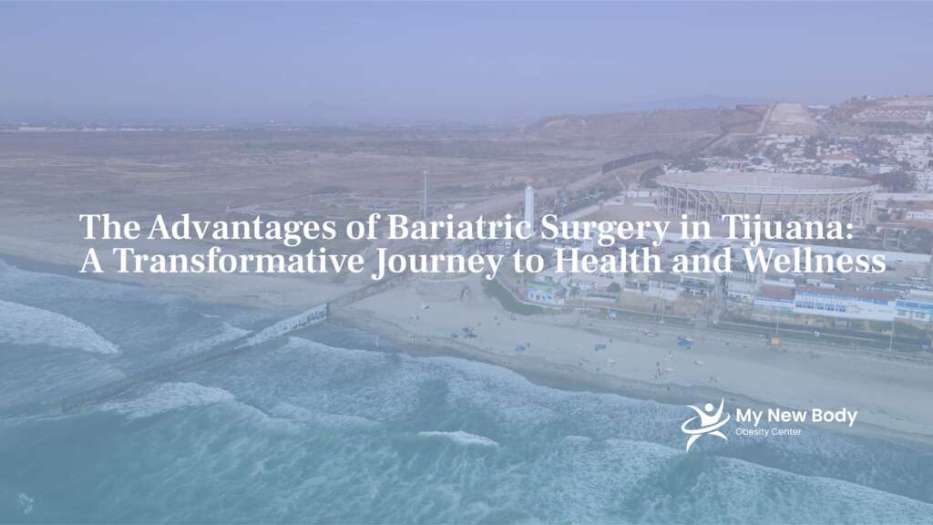 Bariatric Surgery in Tijuana