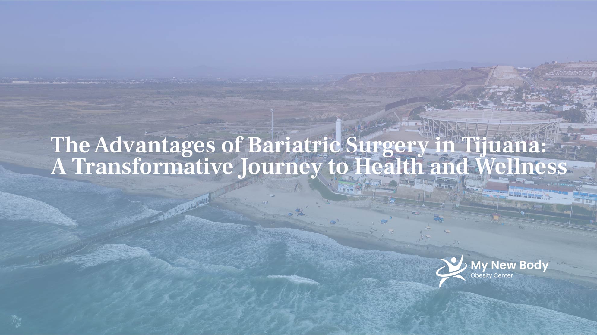 Bariatric Surgery in Tijuana