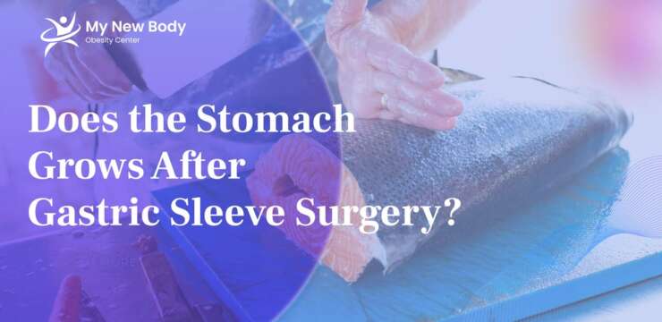 Does the Stomach Grows after Gastric Sleeve Surgery?