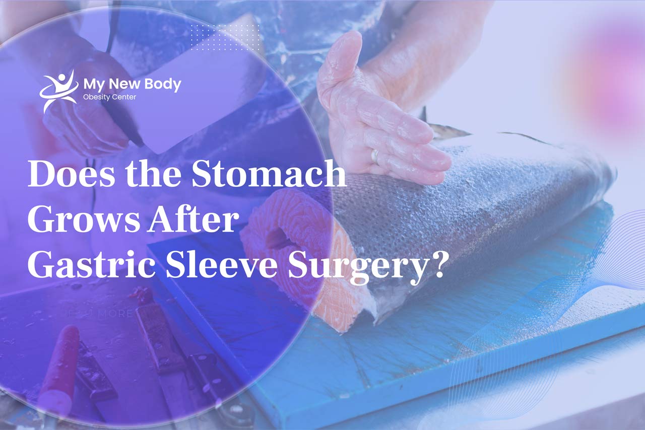 Does the Stomach Grows after Gastric Sleeve Surgery?