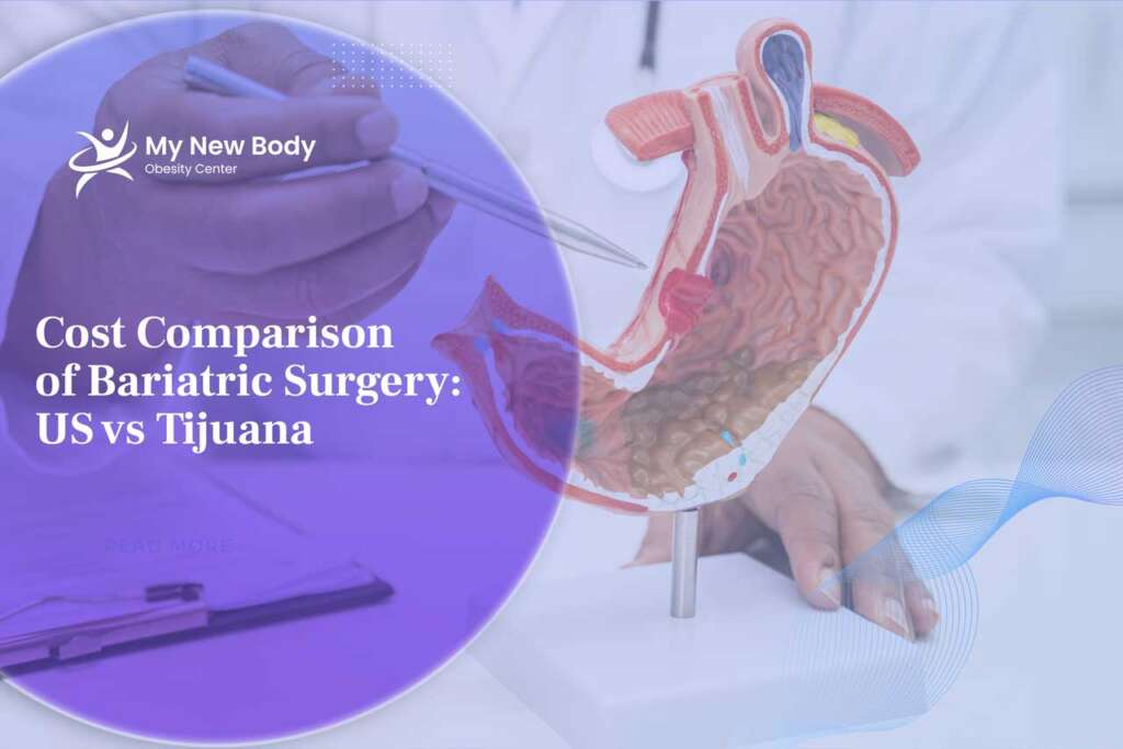 Cost Comparison of Bariatric Surgery