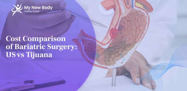 Cost Comparison of Bariatric Surgery