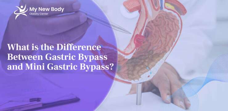 What is the difference between Mini Gastric Bypass and Gastric Bypass?